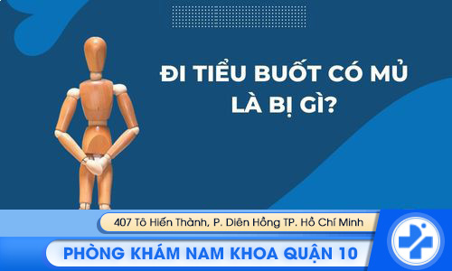 Đi tiểu buốt có mủ là dấu hiệu của nhiều bệnh lý nguy hiểm. Đi tiểu buốt có mủ là bị gì?