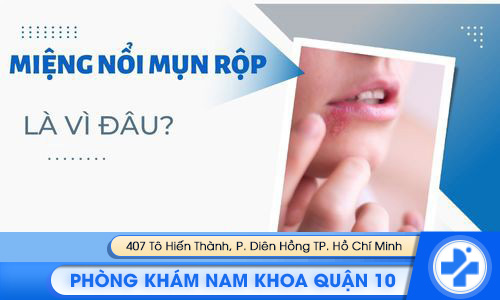 miệng nổi mụn rộp