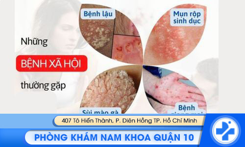 Tổng đài tư vấn bệnh xã hội miễn phí